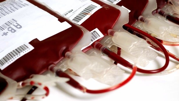 ساخت سانتریفیوژهای «های تک» برای فرآوری خون