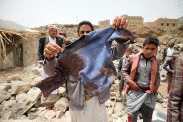 هشتمین سال‌گرد جنگ یمن و نتایج پندآموز آن
