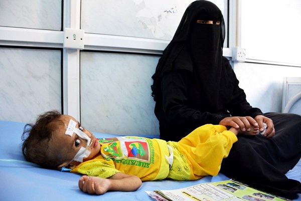 الصحة اليمنية تحذّر من كارثة صحية بالبلاد إذا لم يتوقف العدوان السعودي