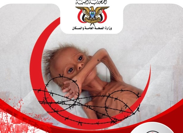أرقام صادمة لعدد الضحايا الأطفال إثر العدوان السعودي على اليمن (صور)