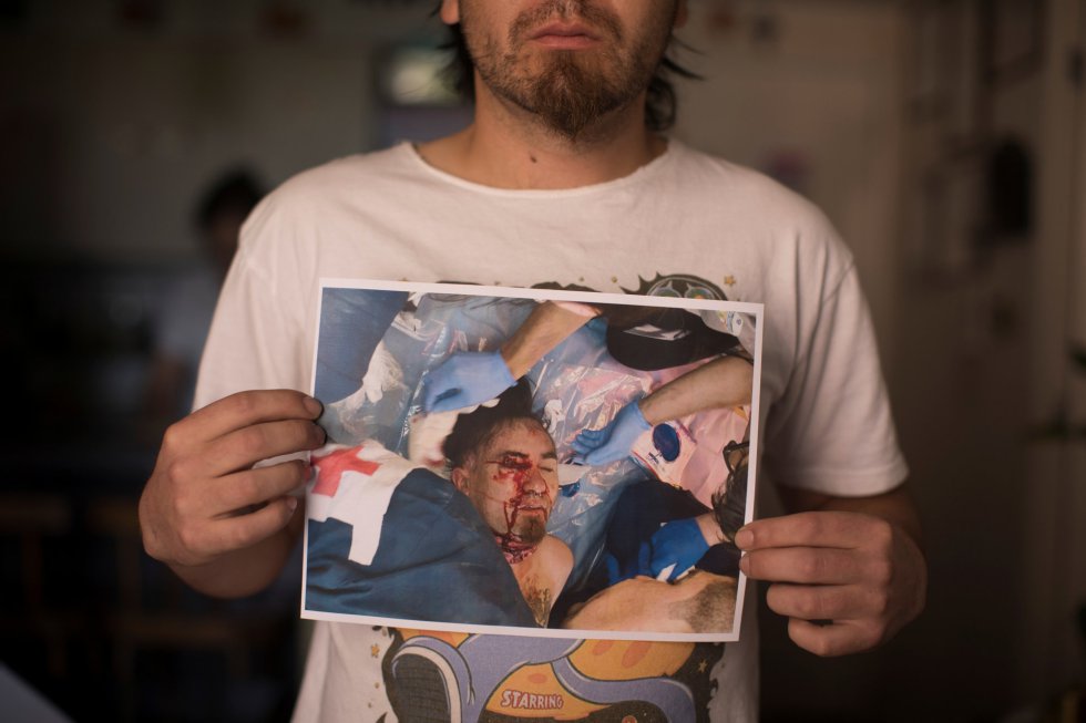إحتجاجات تشيلي تتسبب بفقدان 200 شخص لأعينهم! (صور)