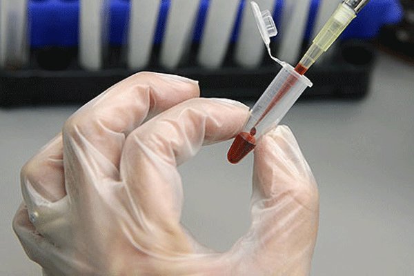 ایران دارای بزرگترین ظرفیت ذخیره سازی سلولهای بنیادی خون بندناف خاورمیانه