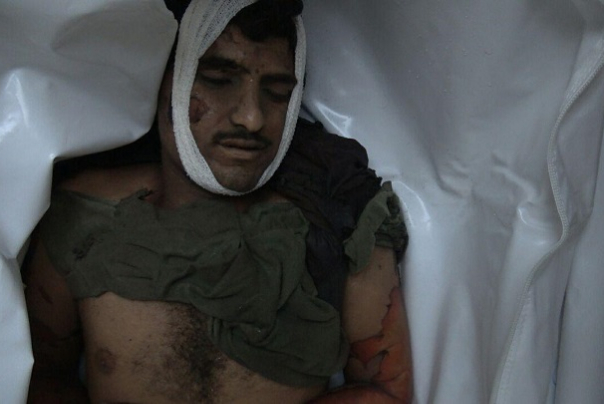 اليمن.. عشرات الشهداء والجرحى إثر العدوان في الجوف وصعدة