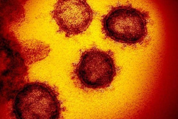 أول صور حقيقية لفيروس كورونا تحت المجهر