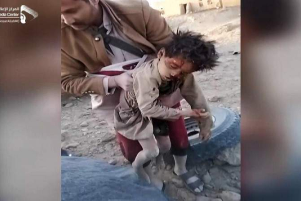 إدانات واسعة لجريمة العدوان السعودي بحق المدنيين في الجوف باليمن