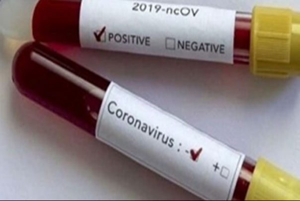 ايران تكسر الحظر.. وتصنّع عدّة لتشخيص فيروس كورونا