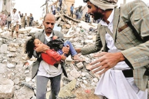 إصابة طفلة جراء قصف صاروخي سعودي على صعدة باليمن