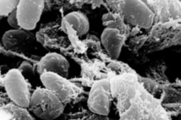 المصائب تأتي تباعاً على أمريكا.. الطاعون الدبلي يطرق الأبواب بعد كورونا