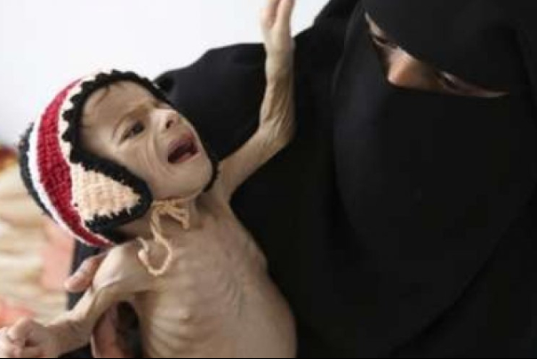 خطر وقوع فاجعه انسانی در یمن جدی‌تر شد