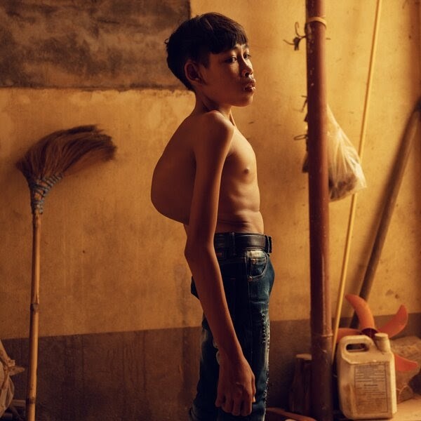 "نيويورك تايمز" تكشف عن جرائم كيميائية ارتكبتها امريكا في لاوس