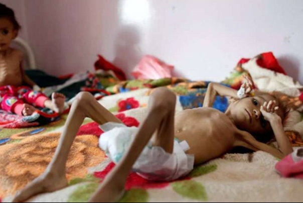 صنعاء تدين جريمة الحصار بحق الشعب اليمني