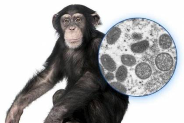 ما الذي نعرفه عن سبل الوقاية من جدري القرود؟
