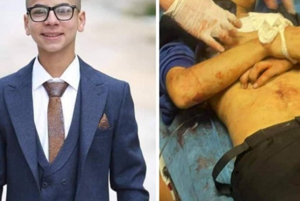 جريمة أخرى للإحتلال في نابلس والضحية فتى لا يتجاوز عمره 16 عاما