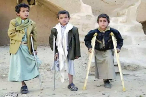 اليمن: 46 ضحية جراء مخلفات العدوان خلال شهر فبراير