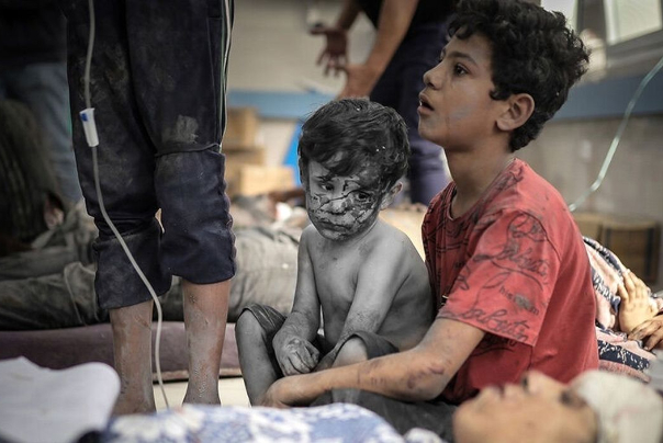 زجرکش‌شدن کودکان در بیمارستان‌های غزه