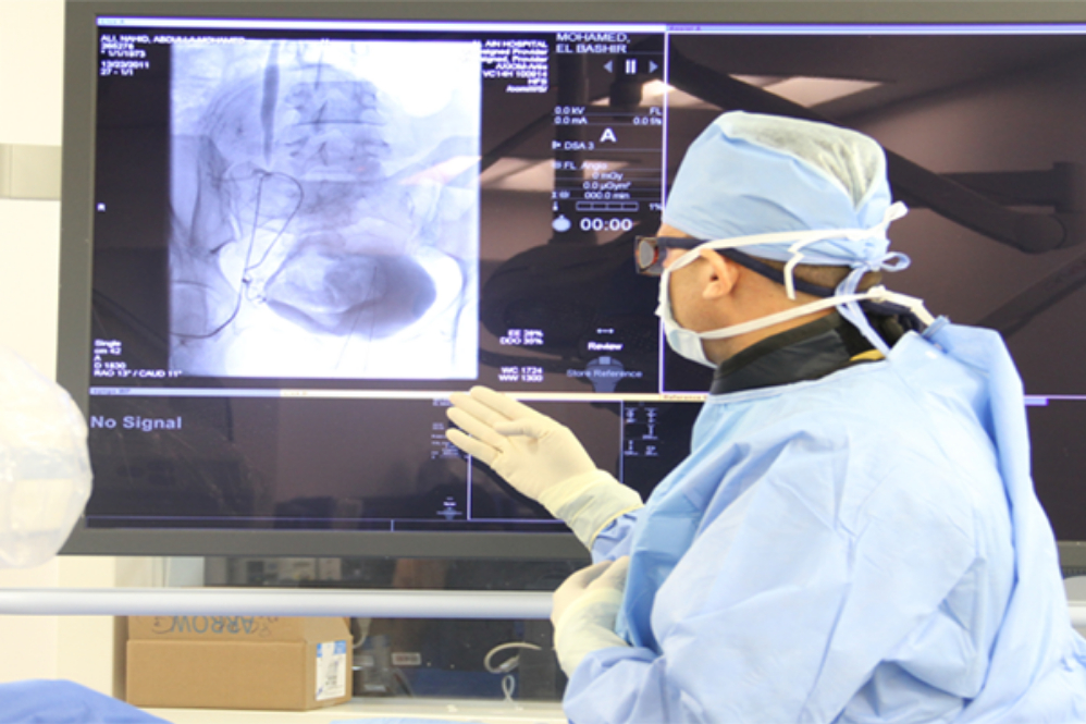 عبر استعمال بخار الماء.. تقنية جديدة لعلاج تضخم البروستاتا الحميد