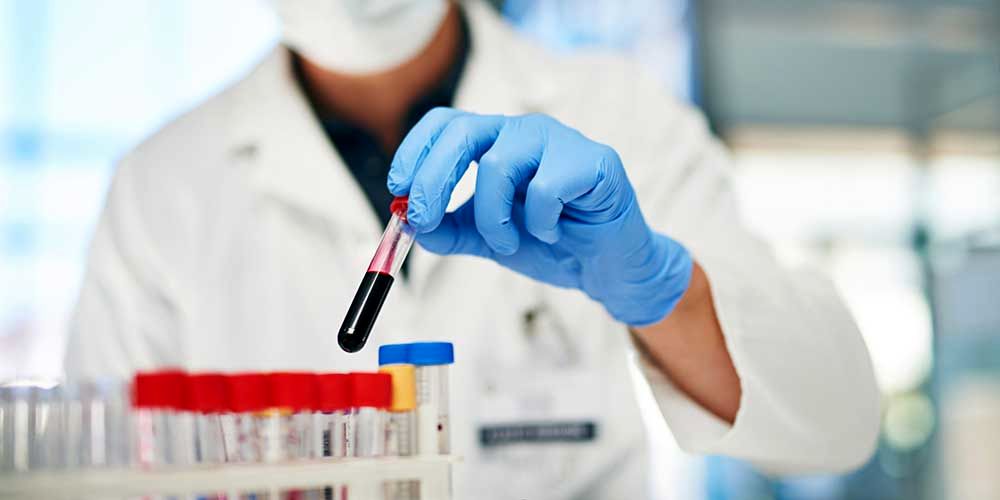 تشخیص بیش از 50 نوع سرطان با نوع جدید آزمایش خون