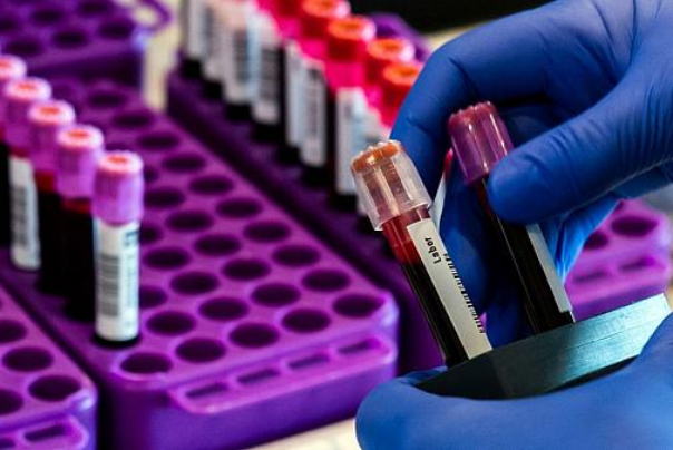 Ability to perform 15,000 Covid 19 tests daily in Iran
