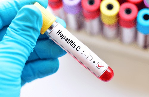 Iran aims to wipe out hepatitis C by 2026 with WHO support