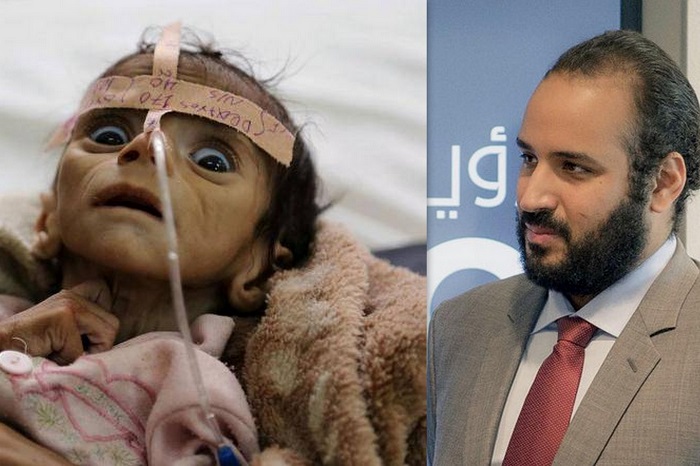 بن سلمان ينفق 4 مليارات دولار لإستضافة بطولة ملاكمة.. واليمن تعيش مجاعة بسببه
