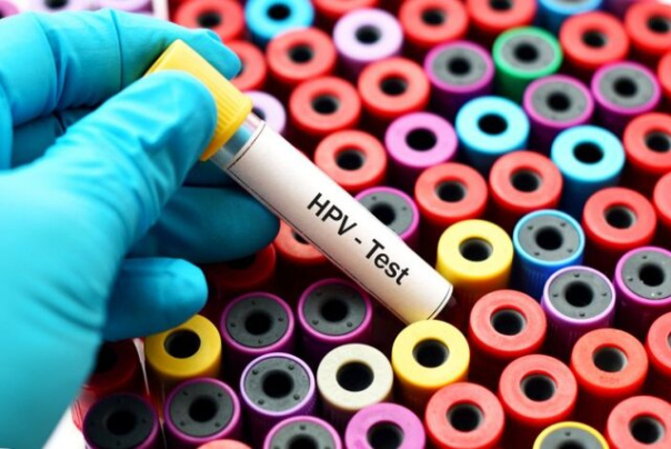 نرخ 5 تا 9 درصدی ابتلا به HPV در کشور/تاثیر آلودگی هوا در فوت زودتر شهروندان