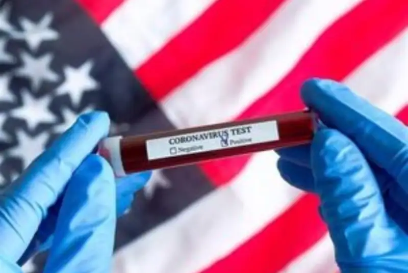 سانسور شدید کرونا در امریکا / آزمایش472 نفر مثبت اعلام شد