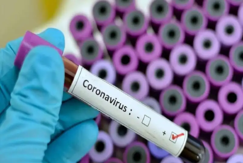 طرح تحول سلامت و مدیریت بحران کرونا در ایران