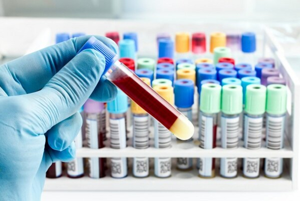 Bioactor became the "Iran Made" cell culture culture