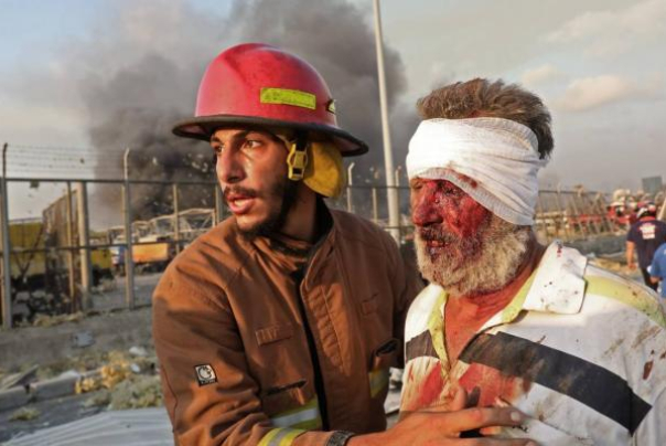 إصابة 10 عراقيين في انفجار بيروت