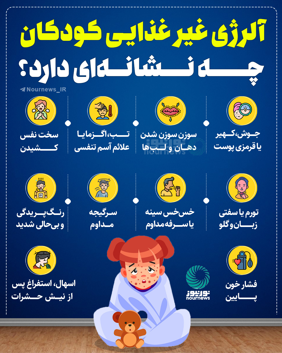 آلرژی غذایی کودکان چه نشانه‌هایی دارد؟