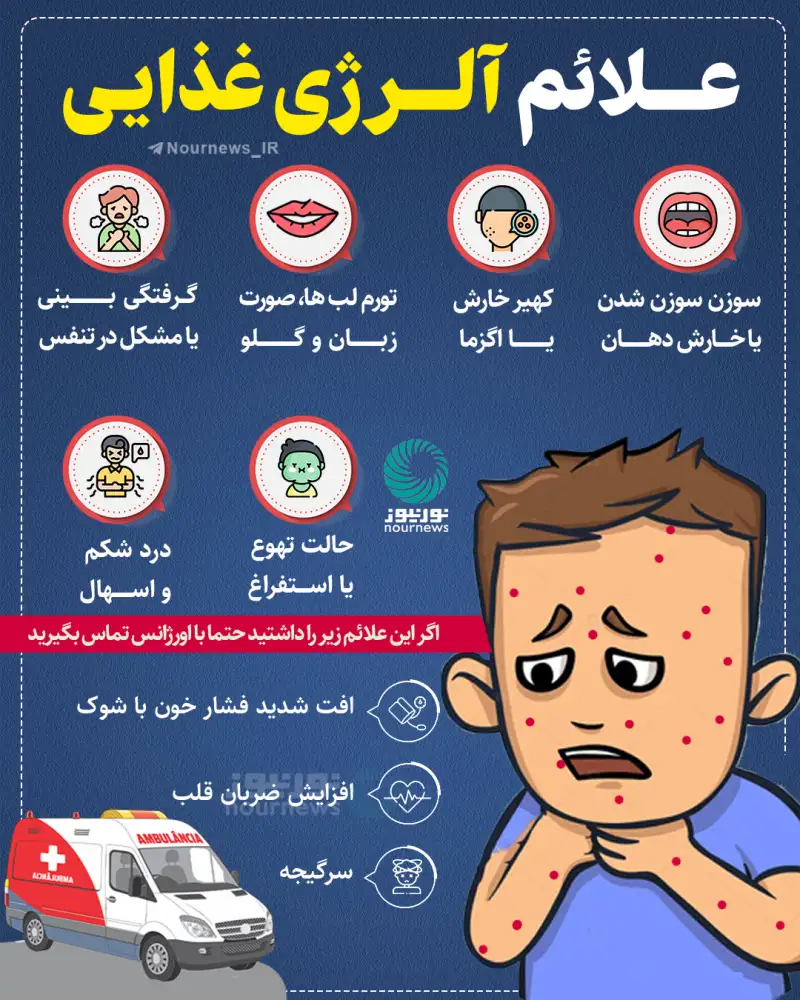 علائم آلرژی غذایی