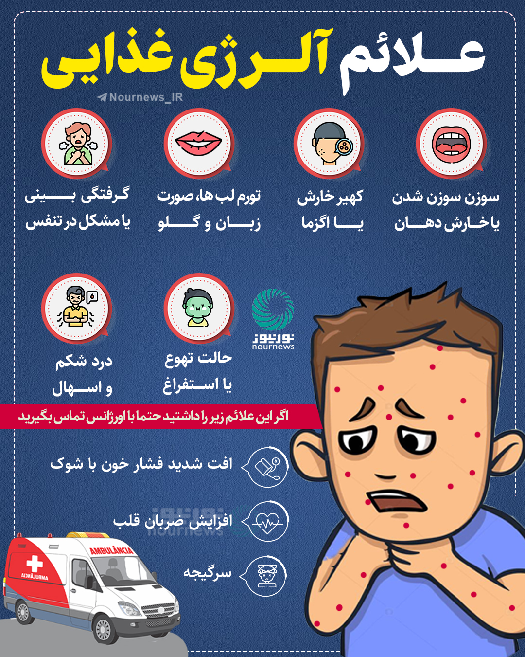 علائم آلرژی غذایی