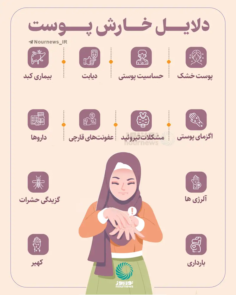 دلایل خارش پوست