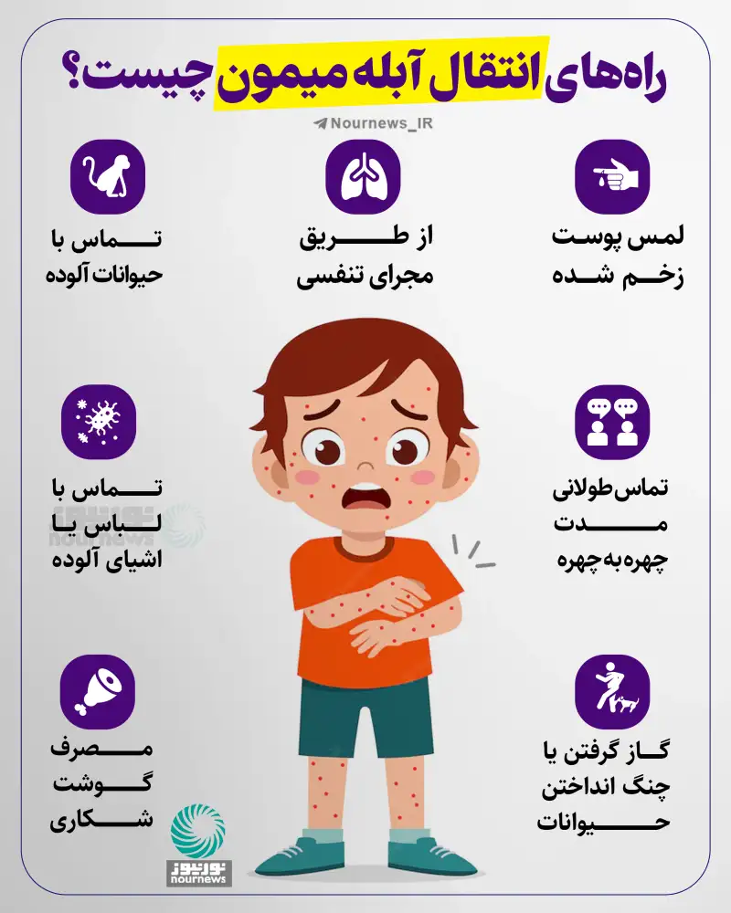 راه‌های انتقال آبله میمون چیست؟