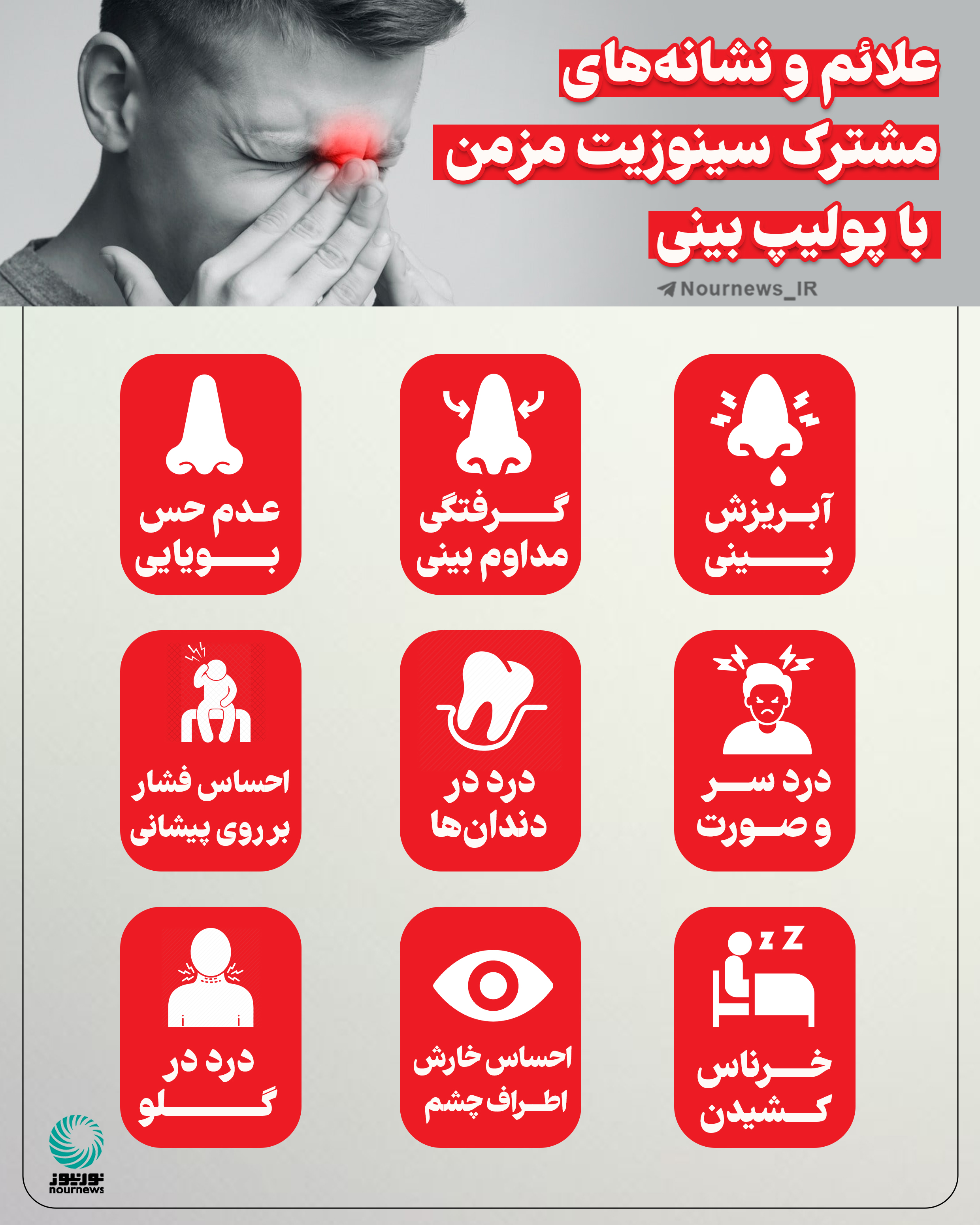 علائم و نشانه‌های مشترک سینوزیت مزمن با پولیپ بینی