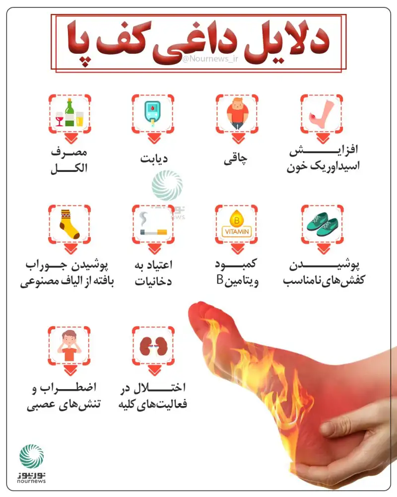 دلایل داغی کف پا