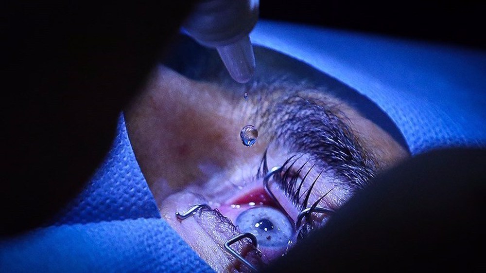 Iran ranks first in ophthalmology in West Asia, can compete with advanced countries