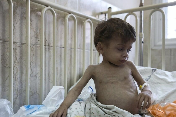 Seven Palestinian kids die of malnutrition amid Gaza war: Report