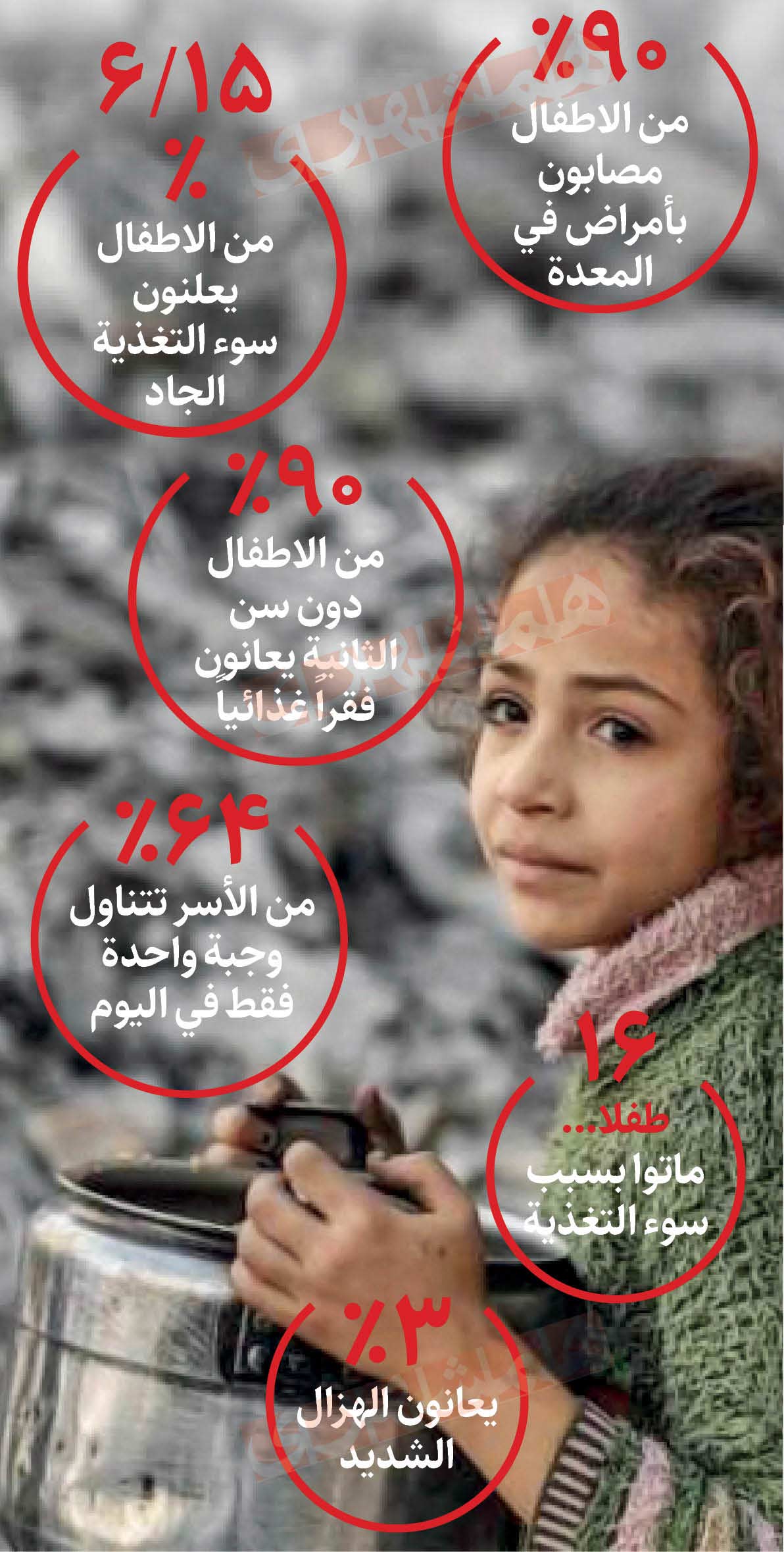 غزة تتضور جوعاً