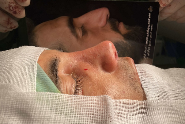 رواج زیبایی‌های غیرمتعارف