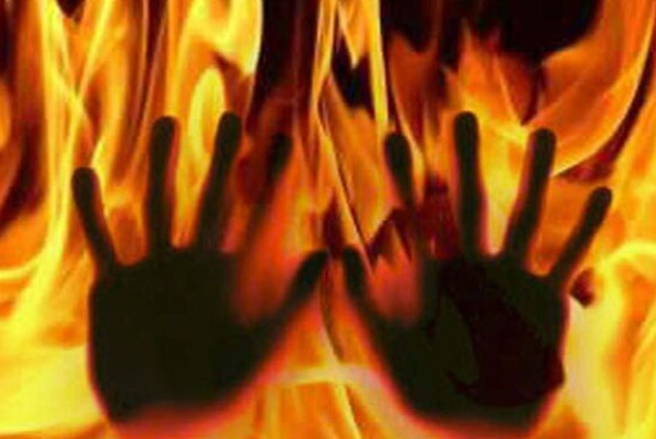 مردی میانسال زن و مادرزنش را آتش زد