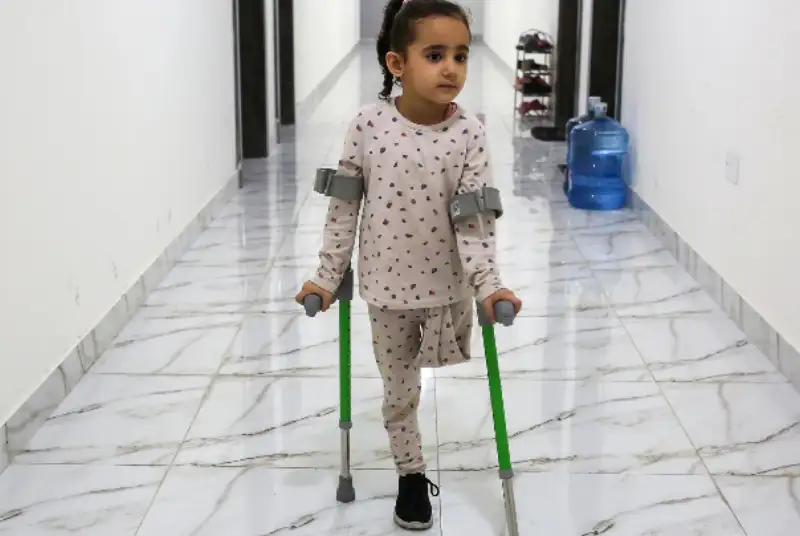 انجام 4 هزار و 50 عمل قطع عضو در غزه