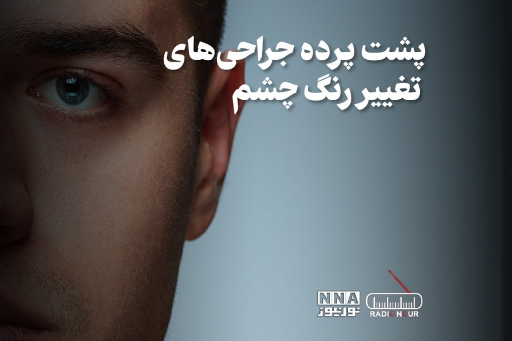 پادکست | پشت پرده جراحی های تغییر رنگ چشم