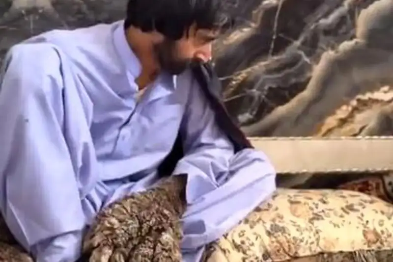 شگفتی های مرد درختی؛ راز عجیب‌ترین بیماری جهان در ایران!