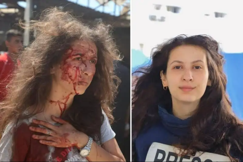 زخمی‌شدن خبرنگار فلسطینی در حمله رژیم صهیونیستی به غزه