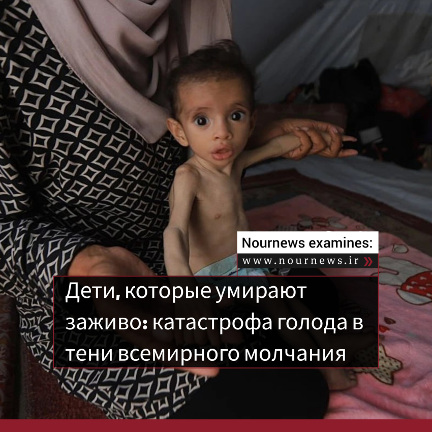 Дети, которые умирают заживо: катастрофа голода в тени всемирного молчания