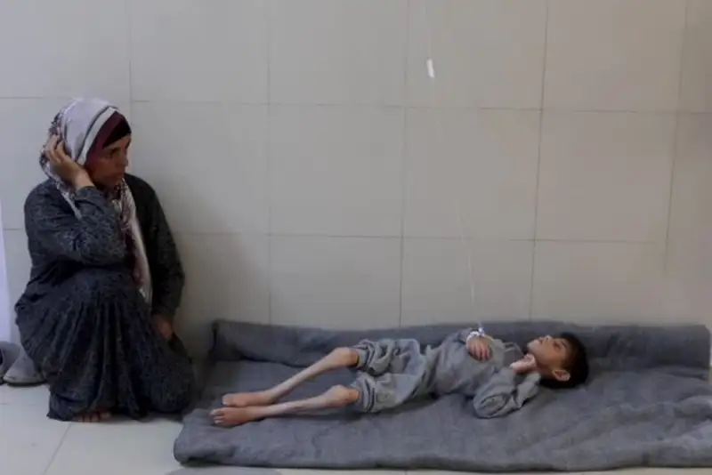 گزارش تکان‌دهنده سازمان ملل: غزه در آستانه قحطی کامل
