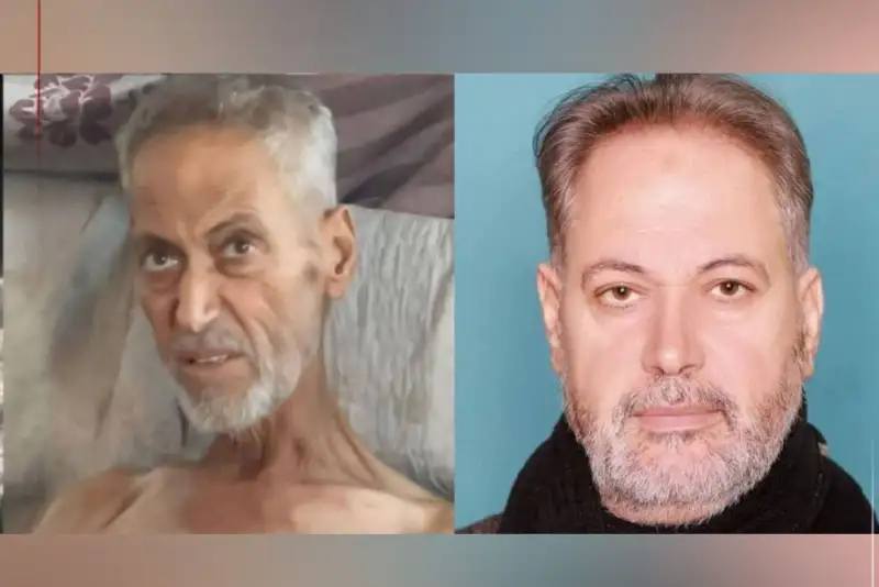 فاجعه انسانی در غزه؛ دکتر فلسطینی به دلیل سوء تغذیه  جان باخت