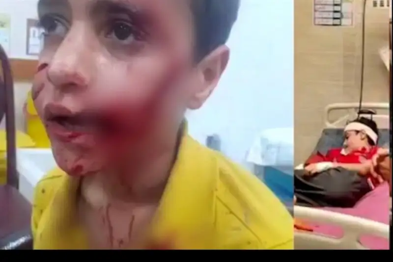 مرگ کودک 11 ساله در حمله سگ‌های ولگرد