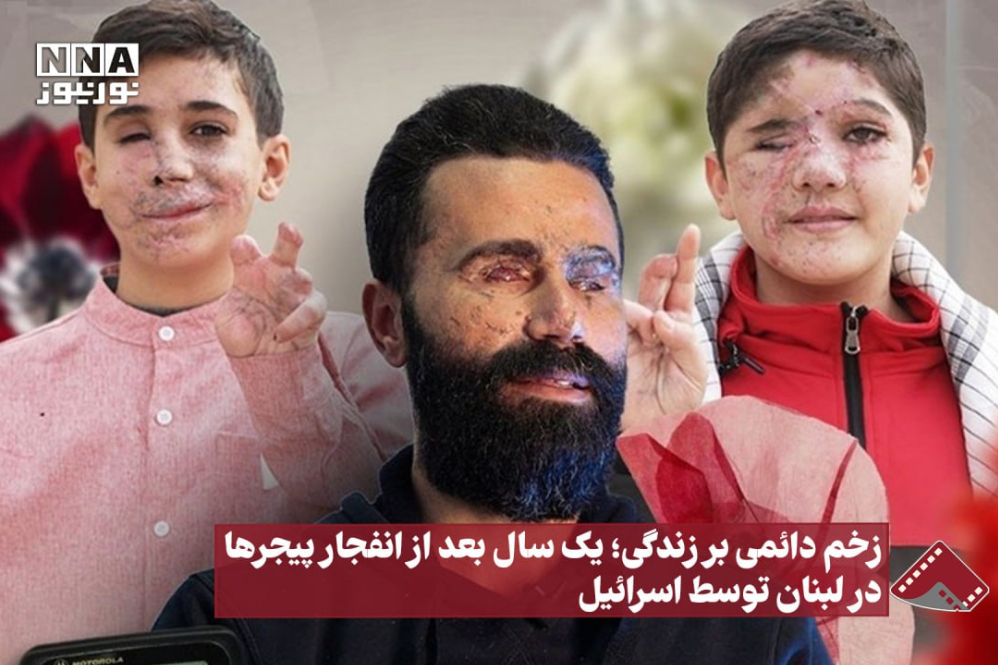نورنما | زخم دائمی بر زندگی؛ یک سال بعد از انفجار پیجرها در لبنان توسط اسرائیل